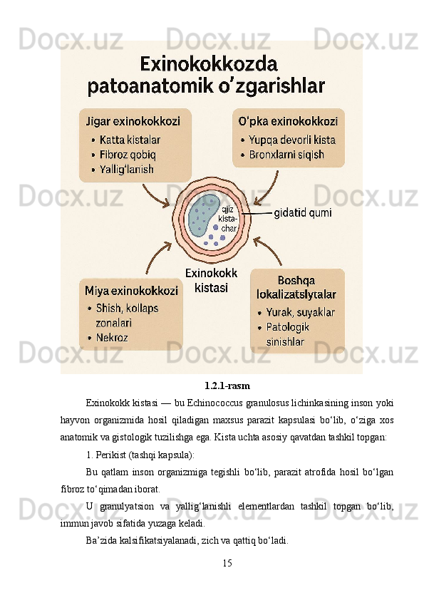 1.2.1-rasm
Exinokokk kistasi — bu Echinococcus granulosus lichinkasining inson yoki
hayvon   organizmida   hosil   qiladigan   maxsus   parazit   kapsulasi   bo‘lib,   o‘ziga   xos
anatomik va gistologik tuzilishga ega. Kista uchta asosiy qavatdan tashkil topgan:
1. Perikist (tashqi kapsula):
Bu   qatlam   inson   organizmiga   tegishli   bo‘lib,   parazit   atrofida   hosil   bo‘lgan
fibroz to‘qimadan iborat.
U   granulyatsion   va   yallig‘lanishli   elementlardan   tashkil   topgan   bo‘lib,
immun javob sifatida yuzaga keladi.
Ba’zida kalsifikatsiyalanadi, zich va qattiq bo‘ladi.
15 