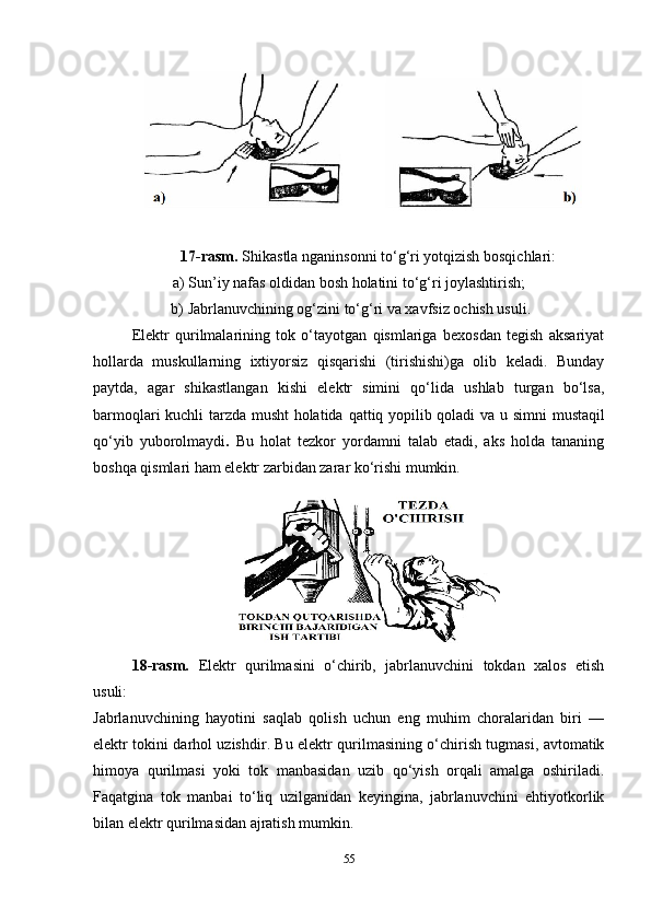 17-rasm.  Shikastla nganinsonni to‘g‘ri yotqizish bosqichlari:
a)  Sun’iy nafas oldidan bosh holatini to‘g‘ri joylashtirish;
 b)  Jabrlanuvchining og‘zini to‘g‘ri va xavfsiz ochish usuli.
Elektr   qurilmalarining   tok   o‘tayotgan   qismlariga   bexosdan   tegish   aksariyat
hollarda   muskullarning   ixtiyorsiz   qisqarishi   (tirishishi)ga   olib   keladi.   Bunday
paytda,   agar   shikastlangan   kishi   elektr   simini   qo‘lida   ushlab   turgan   bo‘lsa,
barmoqlari kuchli tarzda musht holatida   qattiq yopilib qoladi va u   simni mustaqil
qo‘yib   yuborolmaydi .   Bu   holat   tezkor   yordamni   talab   etadi,   aks   holda   tananing
boshqa qismlari ham elektr zarbidan zarar ko‘rishi mumkin.
18-rasm.   Elektr   qurilmasini   o‘chirib,   jabrlanuvchini   tokdan   xalos   etish
usuli:
Jabrlanuvchining   hayotini   saqlab   qolish   uchun   eng   muhim   choralaridan   biri   —
elektr tokini darhol uzish dir. Bu elektr qurilmasining o‘chirish tugmasi, avtomatik
himoya   qurilmasi   yoki   tok   manbasidan   uzib   qo‘yish   orqali   amalga   oshiriladi.
Faqatgina   tok   manbai   to‘liq   uzilganidan   keyingina,   jabrlanuvchini   ehtiyotkorlik
bilan elektr qurilmasidan ajratish mumkin.
5 