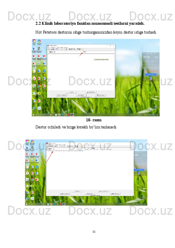 2.2 Klinik laboratoriya fanidan muaommoli testlarni yaratish.
Hot Patatoes dasturini ishga tushurganimizdan keyin dastur ishga tushadi.
10- rasm
Dastur ochiladi va bizga kerakli bo‘lim tanlanadi.
 
11 