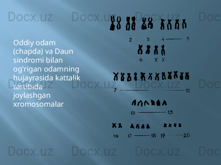 Oddiy odam 
(chapda) va Daun 
sindromi bilan 
og'rigan odamning 
hujayrasida kattalik 
tartibida 
joylashgan 
xromosomalar 