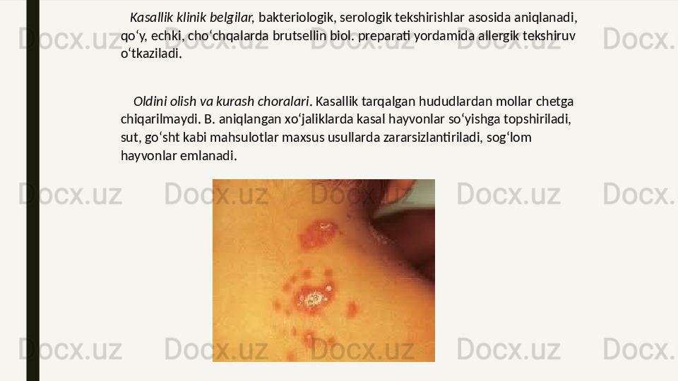 Kasallik klinik belgilar,  bakteriologik, serologik tekshirishlar asosida aniqlanadi, 
qoʻy, echki, choʻchqalarda brutsellin biol. preparati yordamida allergik tekshiruv 
oʻtkaziladi.
 
     Oldini olish va kurash choralari . Kasallik tarqalgan hududlardan mollar chetga 
chiqarilmaydi. B. aniqlangan xoʻjaliklarda kasal hayvonlar soʻyishga topshiriladi, 
sut, goʻsht kabi mahsulotlar maxsus usullarda zararsizlantiriladi, sogʻlom 
hayvonlar emlanadi.