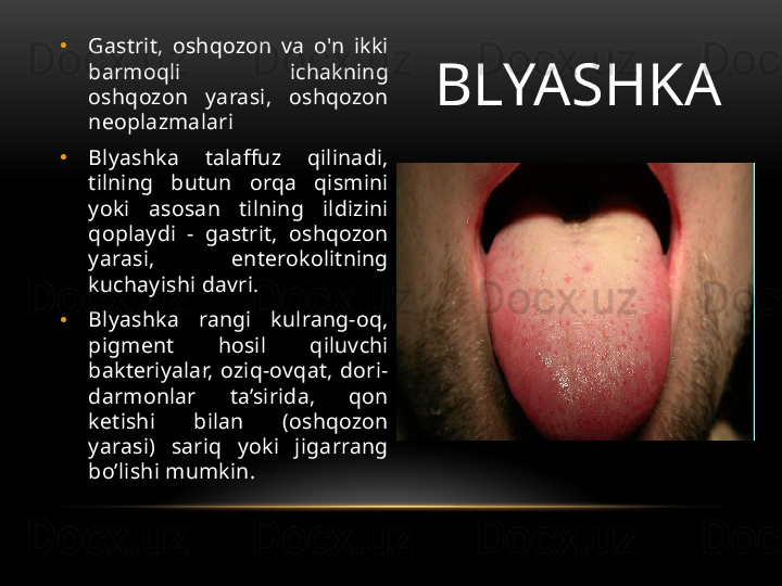 BLYASHKA•
Gastrit,  oshqozon  va  o'n  ikki 
barmoqli  ichakning 
oshqozon  yarasi,  oshqozon 
neoplazmalari
•
Blyashka  talaffuz  qilinadi, 
tilning  butun  orqa  qismini 
yoki  asosan  tilning  ildizini 
qoplaydi  -  gastrit,  oshqozon 
yarasi,  enterokolitning 
kuchayishi davri.
•
Blyashka  rangi  kulrang-oq, 
pigment  hosil  qiluvchi 
bakteriyalar,  oziq-ovqat,  dori-
darmonlar  ta’sirida,  qon 
ketishi  bilan  (oshqozon 
yarasi)  sariq  yoki  jigarrang 
bo’lishi mumkin. 