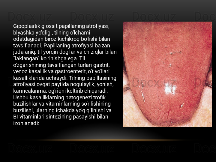 Gipoplastik glossit papillaning atrofiyasi, 
blyashka yo'qligi, tilning o'lchami 
odatdagidan biroz kichikroq bo'lishi bilan 
tavsiflanadi. Papillaning atrofiyasi ba'zan 
juda aniq, til yorqin dog'lar va chiziqlar bilan 
"laklangan" ko'rinishga ega. Til 
o'zgarishining tavsiflangan turlari gastrit, 
venoz kasallik va gastroenterit, o't yo'llari 
kasalliklarida uchraydi. Tilning papillasining 
atrofiyasi ovqat paytida noqulaylik, yonish, 
karıncalanma, og'riqni keltirib chiqaradi. 
Ushbu kasalliklarning patogenezi trofik 
buzilishlar va vitaminlarning so'rilishining 
buzilishi, ularning ichakda yo'q qilinishi va 
BI vitaminlari sintezining pasayishi bilan 
izohlanadi: 