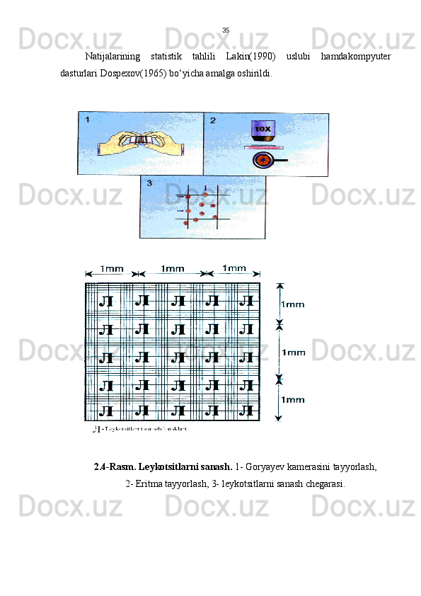 35
Natijalarining     statistik     tahlili     Lakin(1990)     uslubi     hamdakompyuter
dasturlari Dospexov(1965) bo‘yicha amalga oshirildi.
2.4-Rasm. Leykotsitlarni sanash.  1- Goryayev kamerasini tayyorlash,
2- Eritma tayyorlash, 3- leykotsitlarni sanash chegarasi. 