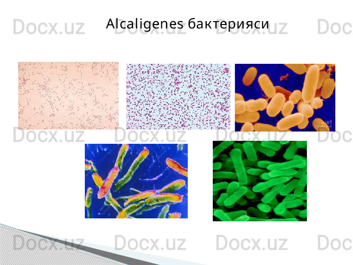 Alcaligenes  бак тери яси     