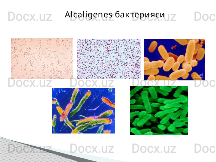 Alcaligenes  бак тери яси