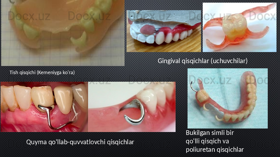 Tish qisqichi (Kemeniyga ko'ra) Gingival qisqichlar (uchuvchilar)
Quyma qo'llab-quvvatlovchi qisqichlar Bukilgan simli bir 
qo'lli qisqich va 
poliuretan qisqichlar 