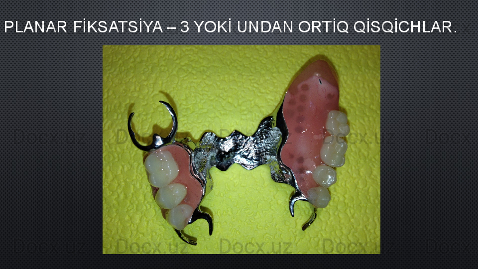 PLANAR FİKSATSİYA – 3 YOKİ UNDAN ORTİQ QİSQİCHLAR . 