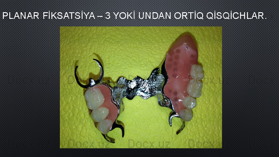 PLANAR FİKSATSİYA – 3 YOKİ UNDAN ORTİQ QİSQİCHLAR .