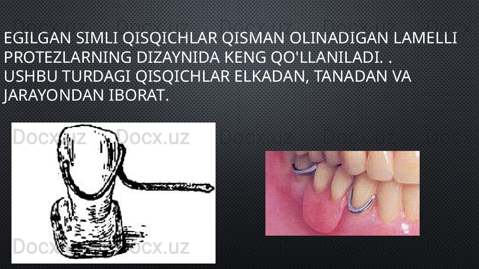 EGILGAN SIMLI QISQICHLAR QISMAN OLINADIGAN LAMELLI 
PROTEZLARNING DIZAYNIDA KENG QO'LLANILADI.  . 
USHBU TURDAGI QISQICHLAR ELKADAN, TANADAN VA 
JARAYONDAN IBORAT .  