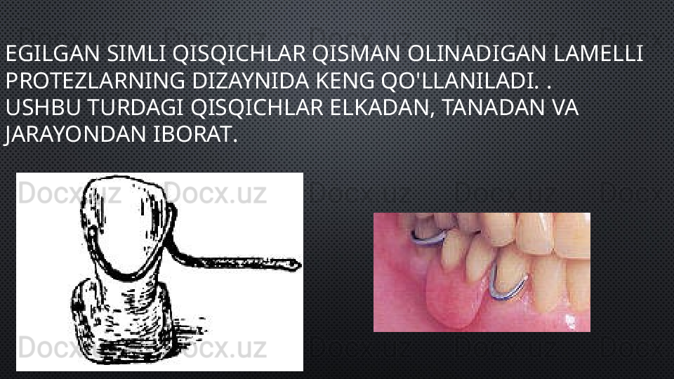 EGILGAN SIMLI QISQICHLAR QISMAN OLINADIGAN LAMELLI 
PROTEZLARNING DIZAYNIDA KENG QO'LLANILADI.  . 
USHBU TURDAGI QISQICHLAR ELKADAN, TANADAN VA 
JARAYONDAN IBORAT .