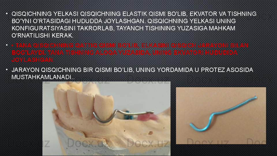 •
QISQICHNING YELKASI QISQICHNING ELASTIK QISMI BO'LIB, EKVATOR VA TISHNING 
BO'YNI O'RTASIDAGI HUDUDDA JOYLASHGAN. QISQICHNING YELKASI UNING 
KONFIGURATSIYASINI TAKRORLAB, TAYANCH TISHINING YUZASIGA MAHKAM 
O'RNATILISHI KERAK.
•
•  TANA QISQICHNING QATTIQ QISMI BO'LIB, ELKASINI QISQICH JARAYONI BILAN 
BOG'LAYDI. TANA TISHNING ALOQA YUZASIDA, UNING EKVATORI HUDUDIDA 
JOYLASHGAN.
•
JARAYON QISQICHNING BIR QISMI BO’LIB, UNING YORDAMIDA U PROTEZ ASOSIDA 
MUSTAHKAMLANADI. . 