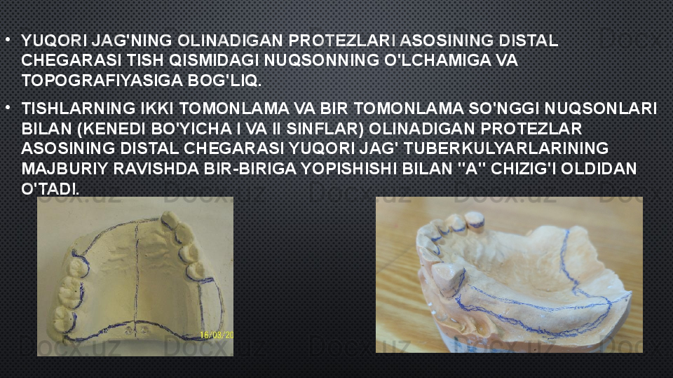 •
YUQORI JAG'NING OLINADIGAN PROTEZLARI ASOSINING DISTAL 
CHEGARASI TISH QISMIDAGI NUQSONNING O'LCHAMIGA VA 
TOPOGRAFIYASIGA BOG'LIQ.
•
TISHLARNING IKKI TOMONLAMA VA BIR TOMONLAMA SO'NGGI NUQSONLARI 
BILAN (KENEDI BO'YICHA I VA II SINFLAR) OLINADIGAN PROTEZLAR 
ASOSINING DISTAL CHEGARASI YUQORI JAG' TUBERKULYARLARINING 
MAJBURIY RAVISHDA BIR-BIRIGA YOPISHISHI BILAN "A" CHIZIG'I OLDIDAN 
O'TADI. 