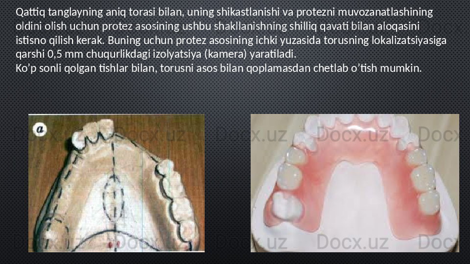 Qattiq tanglayning aniq torasi bilan, uning shikastlanishi va protezni muvozanatlashining 
oldini olish uchun protez asosining ushbu shakllanishning shilliq qavati bilan aloqasini 
istisno qilish kerak. Buning uchun protez asosining ichki yuzasida torusning lokalizatsiyasiga 
qarshi 0,5 mm chuqurlikdagi izolyatsiya (kamera) yaratiladi.
Ko’p sonli qolgan tishlar bilan, torusni asos bilan qoplamasdan chetlab o’tish mumkin. 