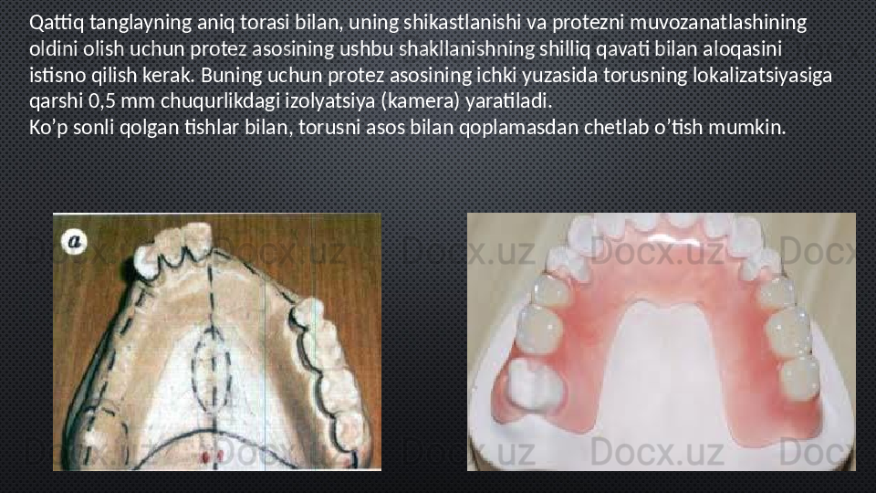 Qattiq tanglayning aniq torasi bilan, uning shikastlanishi va protezni muvozanatlashining 
oldini olish uchun protez asosining ushbu shakllanishning shilliq qavati bilan aloqasini 
istisno qilish kerak. Buning uchun protez asosining ichki yuzasida torusning lokalizatsiyasiga 
qarshi 0,5 mm chuqurlikdagi izolyatsiya (kamera) yaratiladi.
Ko’p sonli qolgan tishlar bilan, torusni asos bilan qoplamasdan chetlab o’tish mumkin.