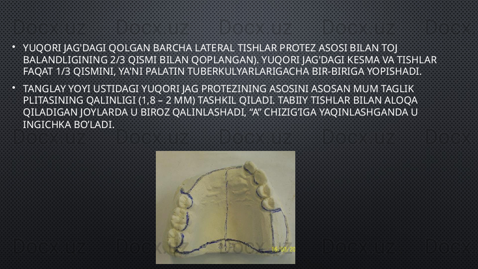 •
YUQORI JAG'DAGI QOLGAN BARCHA LATERAL TISHLAR PROTEZ ASOSI BILAN TOJ 
BALANDLIGINING 2/3 QISMI BILAN QOPLANGAN). YUQORI JAG'DAGI KESMA VA TISHLAR 
FAQAT 1/3 QISMINI, YA'NI PALATIN TUBERKULYARLARIGACHA BIR-BIRIGA YOPISHADI.
•
TANGLAY YOYI USTIDAGI YUQORI JAG PROTEZINING ASOSINI ASOSAN MUM TAGLIK 
PLITASINING QALINLIGI (1,8 – 2 MM) TASHKIL QILADI. TABIIY TISHLAR BILAN ALOQA 
QILADIGAN JOYLARDA U BIROZ QALINLASHADI, “A” CHIZIG’IGA YAQINLASHGANDA U 
INGICHKA BO’LADI. 