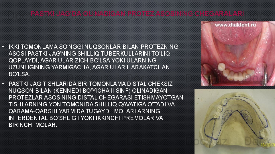 PASTKI JAG'DA OLINADIGAN PROTEZ ASOSINING CHEGARALARI
•
IKKI TOMONLAMA SO'NGGI NUQSONLAR BILAN PROTEZNING 
ASOSI PASTKI JAG'NING SHILLIQ TUBERKULLARINI TO'LIQ 
QOPLAYDI, AGAR ULAR ZICH BO'LSA YOKI ULARNING 
UZUNLIGINING YARMIGACHA, AGAR ULAR HARAKATCHAN 
BO'LSA.
•
PASTKI JAG TISHLARIDA BIR TOMONLAMA DISTAL CHEKSIZ 
NUQSON BILAN (KENNEDI BO’YICHA II SINF) OLINADIGAN 
PROTEZLAR ASOSINING DISTAL CHEGARASI ETISHMAYOTGAN 
TISHLARNING YON TOMONIDA SHILLIQ QAVATIGA O’TADI VA 
QARAMA-QARSHI YARMIDA TUGAYDI. MOLARLARNING 
INTERDENTAL BO’SHLIG’I YOKI IKKINCHI PREMOLAR VA 
BIRINCHI MOLAR.