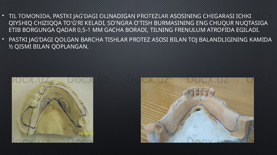 •
TIL TOMONIDA, PASTKI JAG'DAGI OLINADIGAN PROTEZLAR ASOSINING CHEGARASI ICHKI 
QIYSHIQ CHIZIQQA TO'G'RI KELADI, SO'NGRA O'TISH BURMASINING ENG CHUQUR NUQTASIGA 
ETIB BORGUNGA QADAR 0,5-1 MM GACHA BORADI, TILNING FRENULUM ATROFIDA EGILADI.  
•
PASTKI JAG’DAGI QOLGAN BARCHA TISHLAR PROTEZ ASOSI BILAN TOJ BALANDLIGINING KAMIDA 
½ QISMI BILAN QOPLANGAN.