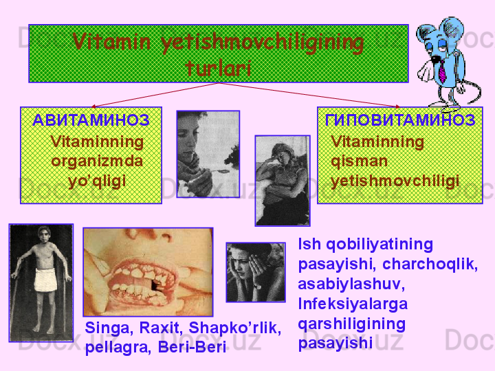 Vitamin yetishmovchiligining 
turlari
АВИТАМИНОЗ ГИПОВИТАМИНОЗ
Vitaminning 
organizmda 
yo’qligi
Singa ,  Raxit ,  Shapko’rlik , 
pellagra ,  Beri-Beri Vitaminning  
qisman  
yetishmovchiligi
Ish qobiliyatining 
pasayishi, charchoqlik , 
asabiylashuv , 
Infeksiyalarga 
qarshiligining 
pasayishi 