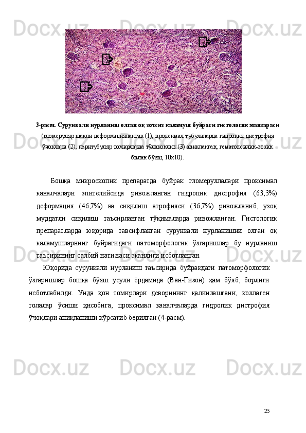 3-расм. Сурункали нурланиш олган оқ зотсиз каламуш буйраги гистологик манзараси
(гломеруляр шакли деформaцияланган (1), проксимал тубулаларда гидропик дистрофия
ўчоқлари (2), перитубуляр томирларда тўлақонлик (3) аниқланган, гематоксилин-эозин
билан бўяш, 10х10). 
 
Бошқа   микроскопик   препаратда   буйрак   гломеруллалари   проксимал
каналчалари   эпителийсида   ривожланган   гидропик   дистрофия   (63,3%)
деформaция   (46,7%)   ва   сиқилиш   атрофияси   (36,7%)   ривожланиб,   узоқ
муддатли   сиқилиш   таъсирланган   тўқималарда   ривожланган.   Гистологик
препаратларда   юқорида   тавсифланган   сурункали   нурланишни   олган   оқ
каламушларнинг   буйрагидаги   патоморфологик   ўзгаришлар   бу   нурланиш
таъсирининг салбий натижаси эканлиги исботланган. 
Юқорида   сурункали   нурланиш   таъсирида   буйракдаги   патоморфологик
ўзгаришлар   бошқа   бўяш   усули   ёрдамида   (Ван-Гизон)   ҳам   бўяб,   борлиги
исботлабилди.   Унда   қон   томирлари   деворининг   қалинлашгани,   коллаген
толалар   ўсиши   ҳисобига,   проксимал   каналчаларда   гидропик   дистрофия
ўчоқлари аниқланиши кўрсатиб берилган (4-расм). 
25                  1  
2   3   