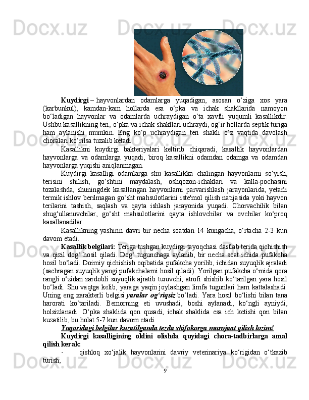 Kuydirgi   –   hayvonlardan   odamlarga   yuqadigan,   asosan   o‘ziga   xos   yara
(karbunkul),   kamdan-kam   hollarda   esa   o‘pka   va   ichak   shakllarida   namoyon
bo‘ladigan   hayvonlar   va   odamlarda   uchraydigan   o‘ta   xavfli   yuqumli   kasallikdir.
Ushbu kasallikning teri, o‘pka va ichak shakllari uchraydi, og‘ir hollarda septik turiga
ham   aylanishi   mumkin.   Eng   ko‘p   uchraydigan   teri   shakli   o‘z   vaqtida   davolash
choralari ko‘rilsa tuzalib ketadi.
Kasallikni   kuydirgi   bakteriyalari   keltirib   chiqaradi,   kasallik   hayvonlardan
hayvonlarga   va   odamlarga   yuqadi,   biroq   kasallikni   odamdan   odamga   va   odamdan
hayvonlarga yuqishi aniqlanmagan.
Kuydirgi   kasalligi   odamlarga   shu   kasallikka   chalingan   hayvonlarni   so‘yish,
terisini   shilish,   go‘shtini   maydalash,   oshqozon-ichaklari   va   kalla-pochasini
tozalashda,   shuningdek   kasallangan   hayvonlarni   parvarishlash   jarayonlarida,   yetarli
termik ishlov berilmagan go‘sht mahsulotlarini iste'mol qilish natijasida yoki hayvon
terilarini   tashish,   saqlash   va   qayta   ishlash   jarayonida   yuqadi.   Chorvachilik   bilan
shug‘ullanuvchilar,   go‘sht   mahsulotlarini   qayta   ishlovchilar   va   ovchilar   ko‘proq
kasallanadilar.
Kasallikning   yashirin   davri   bir   necha   soatdan   14   kungacha,   o‘rtacha   2-3   kun
davom etadi.
Kasallik belgilari:  Teriga tushgan kuydirgi tayoqchasi dastlab terida qichishish
va   qizil   dog‘   hosil   qiladi.   Dog‘   tugunchaga   aylanib,   bir   necha   soat   ichida   pufakcha
hosil bo‘ladi. Doimiy qichishish oqibatida pufakcha yorilib, ichidan suyuqlik ajraladi
(sachragan suyuqlik yangi pufakchalarni hosil qiladi). Yorilgan pufakcha o‘rnida qora
rangli o‘zidan zardobli suyuqlik ajratib turuvchi, atrofi shishib ko‘tarilgan yara hosil
bo‘ladi. Shu vaqtga kelib, yaraga yaqin joylashgan limfa tugunlari ham kattalashadi.
Uning   eng   xarakterli   belgisi   yaralar og‘riqsiz   bo‘ladi.   Yara   hosil   bo‘lishi   bilan   tana
harorati   ko‘tariladi.   Bemorning   eti   uvushadi,   boshi   aylanadi,   ko‘ngli   ayniydi,
holsizlanadi.   O‘pka   shaklida   qon   qusadi,   ichak   shaklida   esa   ich   ketishi   qon   bilan
kuzatilib, bu holat 5-7 kun davom etadi.
Yuqoridagi	
 belgilar	 kuzatilganda	 tezda	 shifokorga	 murojaat	 qilish	 lozim!
Kuydirgi   kasalligining   oldini   olishda   quyidagi   chora-tadbirlarga   amal
qilish kerak:
-                   qishloq   xo‘jalik   hayvonlarini   davriy   veterinariya   ko‘rigidan   o‘tkazib
turish;
9 