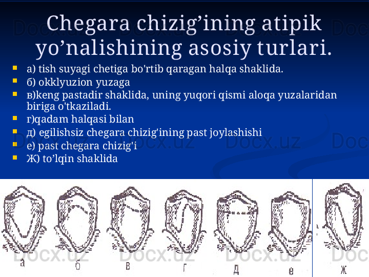 Chegara chizig’ining at ipik  
yo’nalishining asosiy t ur lar i.

а)  tish suyagi chetiga bo'rtib qaragan halqa shaklida.

б)  okklyuzion yuzaga

в) keng pastadir shaklida, uning yuqori qismi aloqa yuzalaridan 
biriga o'tkaziladi.

г) qadam halqasi bilan

д)  egilishsiz chegara chizig'ining past joylashishi

е)  past chegara chizig'i

Ж ) to’lqin shaklida 