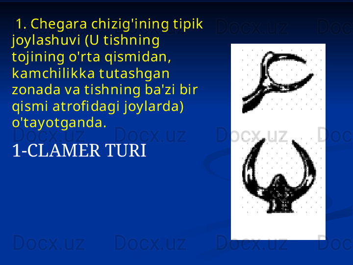   1.  Chegara chizig'ining t ipik  
joy lashuv i (U t ishning 
t ojining o'rt a qismidan, 
k amchilik k a t ut ashgan 
zonada v a t ishning ba'zi bir 
qismi at rofi dagi joy larda) 
o't ay ot ganda.  
1-CLAMER TURI 