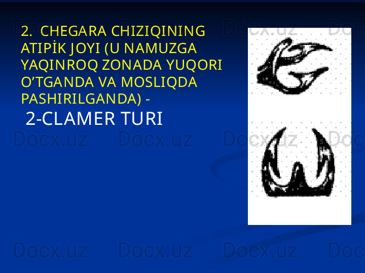 2.   CHEGARA CHIZI QINING 
ATIPİK J OY I (U NAMUZGA 
YAQINROQ ZONADA Y UQORI 
O’ TGANDA VA MOSLIQDA  
PASHI RI LGANDA) -
  2-CLAMER TURI 