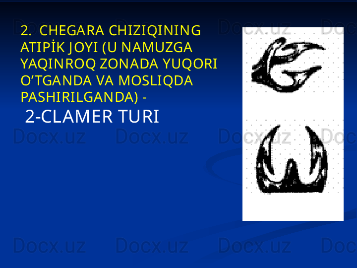 2.   CHEGARA CHIZI QINING 
ATIPİK J OY I (U NAMUZGA 
YAQINROQ ZONADA Y UQORI 
O’ TGANDA VA MOSLIQDA  
PASHI RI LGANDA) -
  2-CLAMER TURI