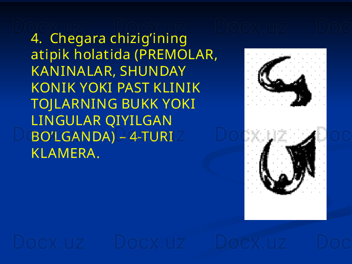 4.   Chegara chizig’ining 
at ipik  holat ida (PREMOLAR, 
KA NINA LAR, SHUNDAY  
KONI K YOKI PA ST KLINIK 
TOJ LA RNING BUKK YOKI 
LINGULA R QI Y ILGAN 
BO’LGANDA) – 4-TURI  
KLAMERA. 