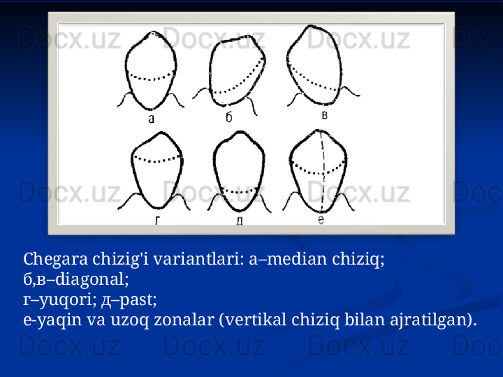 Chegara chizig'i variantlari:  а– median chiziq;
б,в– diagonal ; 
г– yuqori ; д– past ;
е- yaqin va uzoq zonalar (vertikal chiziq bilan ajratilgan). 