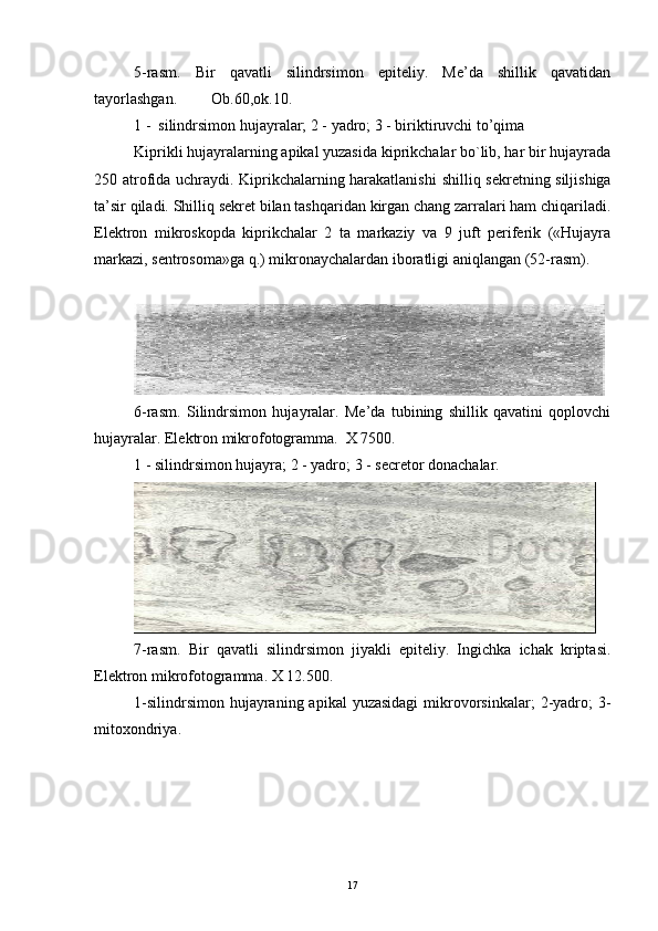 5-rasm.   Bir   qavatli   silindrsimon   epiteliy.   Me’da   shillik   qavatidan
tayorlashgan.  Ob.60,ok.10.
1 -  silindrsimon hujayralar; 2 - yadro; 3 - biriktiruvchi to’qima
Kiprikli hujayralarning apikal yuzasida kiprikchalar bo`lib, har bir hujayrada
250 atrofida uchraydi. Kiprikchalarning harakatlanishi   shilliq sekretning siljishiga
ta’sir qiladi. Shilliq sekret bilan tashqaridan kirgan chang zarralari ham chiqariladi.
Elektron   mikroskopda   kiprikchalar   2   ta   markaziy   va   9   juft   periferik   («Hujayra
markazi, sentrosoma»ga q.) mikronaychalardan iboratligi aniqlangan (52-rasm).
6-rasm.   Silindrsimon   hujayralar.   Me’da   tubining   shillik   qavatini   qoplovchi
hujayralar. Elektron mikrofotogramma.  X 7500.
1 - silindrsimon hujayra; 2 - yadro; 3 - secretor donachalar.
7-rasm.   Bir   qavatli   silindrsimon   jiyakli   epiteliy.   Ingichka   ichak   kriptasi.
Elektron mikrofotogramma. X 12.500.
1-silindrsimon  hujayraning apikal   yuzasidagi  mikrovorsinkalar;   2-yadro;   3-
mitoxondriya.
17 