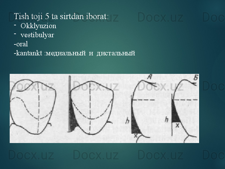 Tish toji 5 ta sirtdan iborat:
-
Okklyuzion  
-
vestibulyar
-oral 
-kantankt : медиальный  и  дистальный  