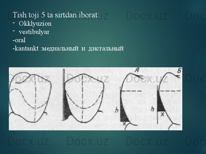 Tish toji 5 ta sirtdan iborat:
-
Okklyuzion  
-
vestibulyar
-oral 
-kantankt : медиальный  и  дистальный