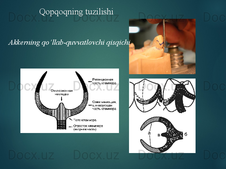 Qopqoqning tuzilishi
Akkerning qo’llab-quvvatlovchi qisqichi  