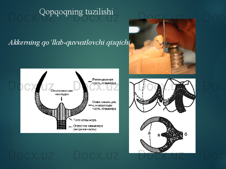 Qopqoqning tuzilishi
Akkerning qo’llab-quvvatlovchi qisqichi