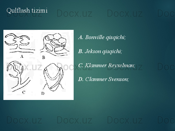 Qulflash tizimi
А.  Bonville qisqichi;
В.  Jekson qisqichi;
С.  Klammer Reyxelman;
D .  Clammer Svenson;  