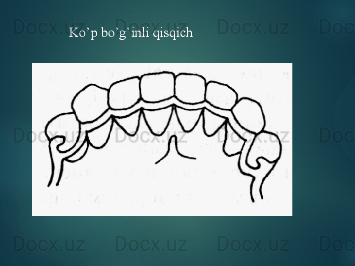 Ko’p bo’g’inli qisqich