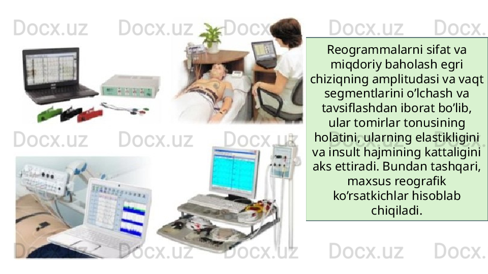 Reogrammalarni sifat va 
miqdoriy baholash egri 
chiziqning amplitudasi va vaqt 
segmentlarini o’lchash va 
tavsiflashdan iborat bo’lib, 
ular tomirlar tonusining 
holatini, ularning elastikligini 
va insult hajmining kattaligini 
aks ettiradi. Bundan tashqari, 
maxsus reografik 
ko’rsatkichlar hisoblab 
chiqiladi. 