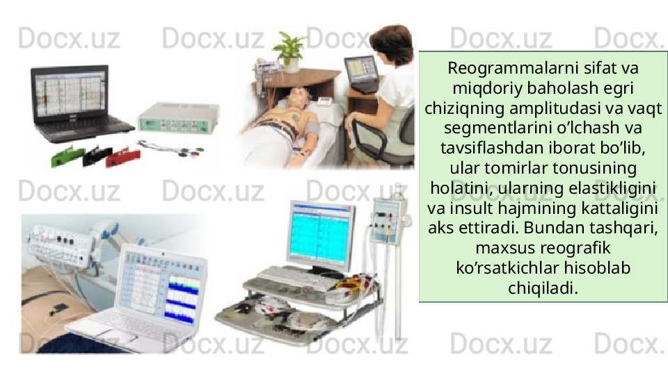 Reogrammalarni sifat va 
miqdoriy baholash egri 
chiziqning amplitudasi va vaqt 
segmentlarini o’lchash va 
tavsiflashdan iborat bo’lib, 
ular tomirlar tonusining 
holatini, ularning elastikligini 
va insult hajmining kattaligini 
aks ettiradi. Bundan tashqari, 
maxsus reografik 
ko’rsatkichlar hisoblab 
chiqiladi.