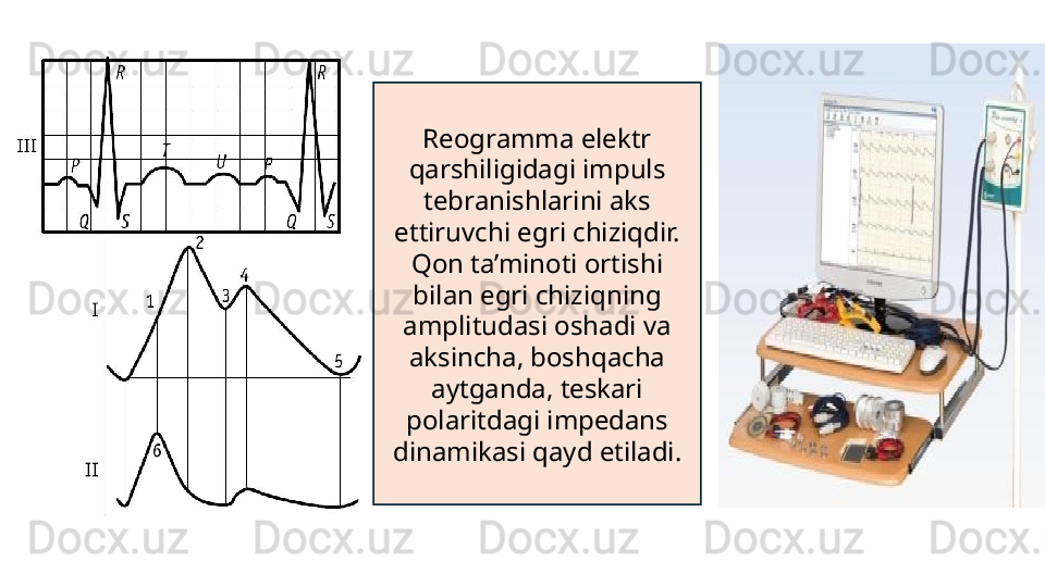 Reogramma elektr 
qarshiligidagi impuls 
tebranishlarini aks 
ettiruvchi egri chiziqdir. 
Qon ta’minoti ortishi 
bilan egri chiziqning 
amplitudasi oshadi va 
aksincha, boshqacha 
aytganda, teskari 
polaritdagi impedans 
dinamikasi qayd etiladi.