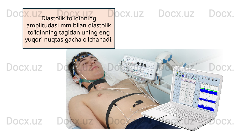 Diastolik to'lqinning 
amplitudasi mm bilan diastolik 
to'lqinning tagidan uning eng 
yuqori nuqtasigacha o'lchanadi.