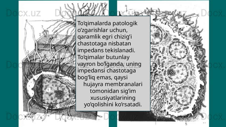 To’qimalarda patologik 
o’zgarishlar uchun, 
qaramlik egri chizig’i
chastotaga nisbatan 
impedans tekislanadi.
To’qimalar butunlay 
vayron bo’lganda, uning 
impedansi chastotaga 
bog’liq emas, qaysi
hujayra membranalari 
tomonidan sig’im 
xususiyatlarining 
yo’qolishini ko’rsatadi.
