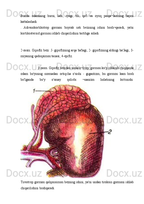 Bunda   odamning   burni,   labi,   iyagi,   tili,   qo'l   va   oyoq   panja¬larining   hajmi
kattalashadi.
.   Adrenokortikotrop   gormon   buyrak   usti   bezining   ishini   bosh¬qaradi,   ya'ni
kortikosteroid gormon ishlab chiqarilishini tartibga soladi.
 
2-rasm. Gipofiz bezi: J- gipofizning arqa ba'lagi; 2- gipofizning aldingi ba'Jagi; 3-
miyaning qadoqsimon tanasi; 4-epifiz.
    3-rasm. Gipofiz bezidan somalo¬lrop; gormon ko'p isblanib cbiqqanda
odam   bo'yining   normadan   ortiqcha   o'sishi   -   gigantizm,   bu   gormon   kam   bosh
bo'lganda   bo'y   o'smay   qolisbi   ¬nanizm   holatining   ko'rinishi.
Tireotrop gormon qalqonsimon bezning ishini, ya'ni undan tiroksin gormoni ishlab
chiqarilishini boshqaradi. 