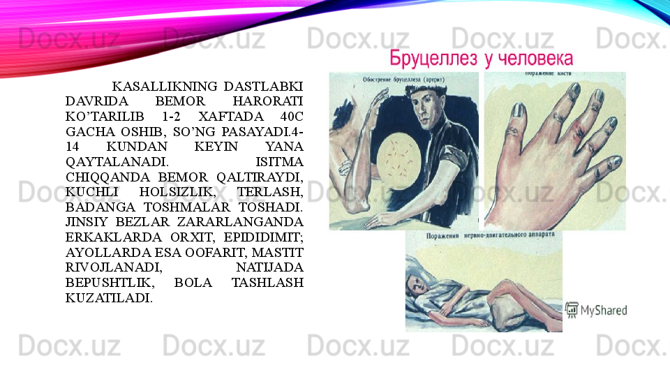               KASALLIKNING  DASTLABKI 
DAVRIDA  BEMOR  HARORATI 
KO’TARILIB  1-2  XAFTADA  40C 
GACHA  OSHIB,  SO’NG  PASAYADI.4-
14  KUNDAN  KEYIN  YANA 
QAYTALANADI.  ISITMA 
CHIQQANDA  BEMOR  QALTIRAYDI, 
KUCHLI  HOLSIZLIK,  TERLASH, 
BADANGA  TOSHMALAR  TOSHADI.
JINSIY  BEZLAR  ZARARLANGANDA 
ERKAKLARDA  ORXIT,  EPIDIDIMIT;
AYOLLARDA  ESA  OOFARIT,  MASTIT 
RIVOJLANADI,  NATIJADA 
BEPUSHTLIK,  BOLA  TASHLASH 
KUZATILADI. 