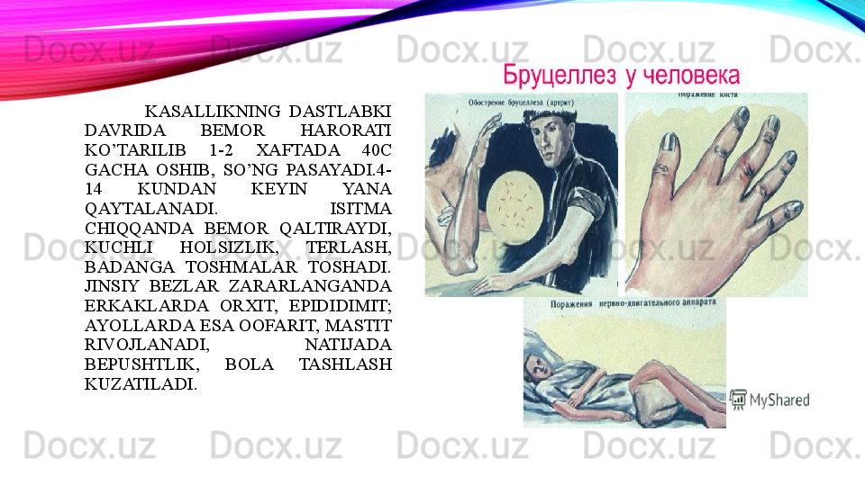 KASALLIKNING  DASTLABKI 
DAVRIDA  BEMOR  HARORATI 
KO’TARILIB  1-2  XAFTADA  40C 
GACHA  OSHIB,  SO’NG  PASAYADI.4-
14  KUNDAN  KEYIN  YANA 
QAYTALANADI.  ISITMA 
CHIQQANDA  BEMOR  QALTIRAYDI, 
KUCHLI  HOLSIZLIK,  TERLASH, 
BADANGA  TOSHMALAR  TOSHADI.
JINSIY  BEZLAR  ZARARLANGANDA 
ERKAKLARDA  ORXIT,  EPIDIDIMIT;
AYOLLARDA  ESA  OOFARIT,  MASTIT 
RIVOJLANADI,  NATIJADA 
BEPUSHTLIK,  BOLA  TASHLASH 
KUZATILADI.