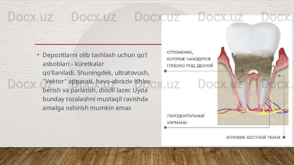 •
Depozitlarni olib tashlash uchun qo'l 
asboblari - küretkalar 
qo'llaniladi. Shuningdek, ultratovush, 
"Vektor" apparati, havo-abraziv ishlov 
berish va parlatish, diodli lazer. Uyda 
bunday tozalashni mustaqil ravishda 
amalga oshirish mumkin emas  